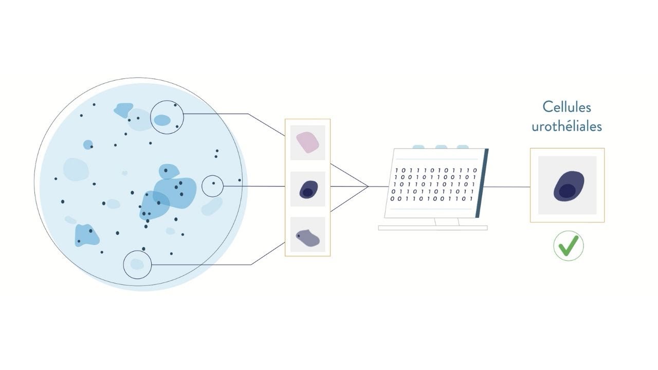 VisioCyt® Bladder : L'IA au service du diagnostic du cancer de la vessie
